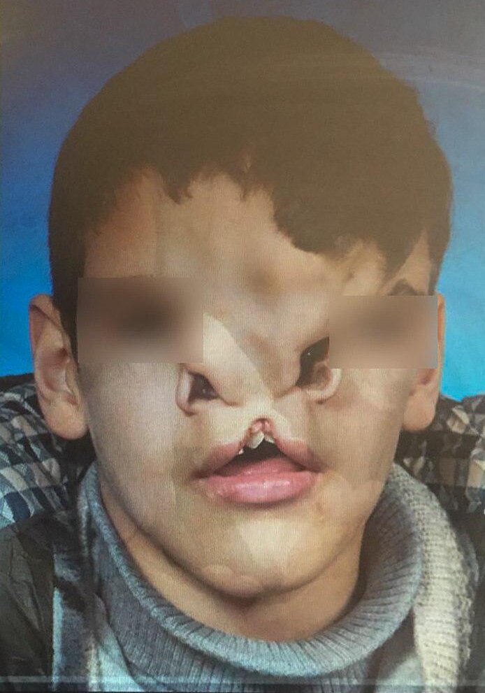 ماجرای ساک پر از پول دکتر و چشم گریان بیمار | روایت داماد و پدرزنی که طبیب بیمارانند