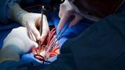 درخواست ۳۰۰۰ یورویی یک پزشک مشهور برای جراحی قلب | ۳۰۰ میلیون تومان برای عمل مچ پا!