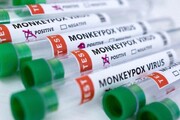 هشدار مقام بهداشتی چین: برای کاهش خطر آبله میمونی «خارجی‌ها» را لمس نکنید