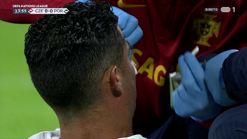 تصاویر | رونالدو و ۴۵ دقیقه نحس! | کریس خونین و مالین شد