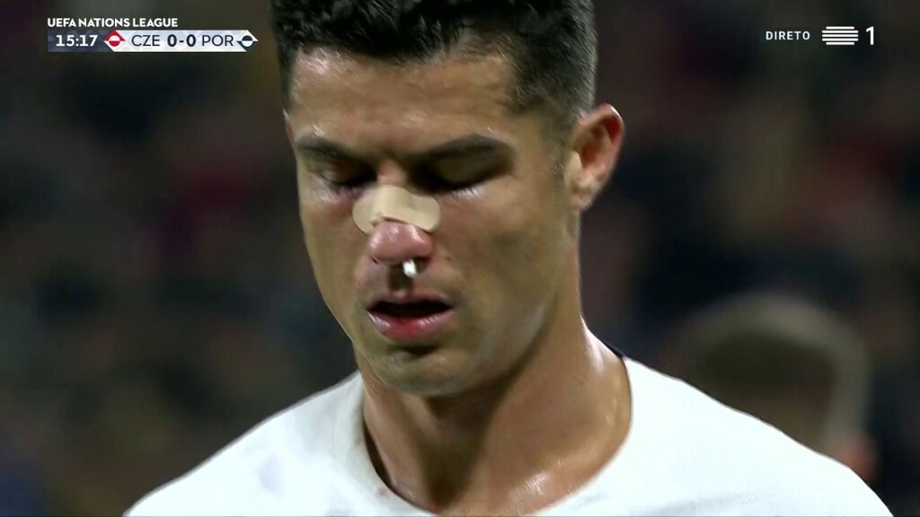 تصاویر | رونالدو و ۴۵ دقیقه نحس! | کریس خونین و مالین شد