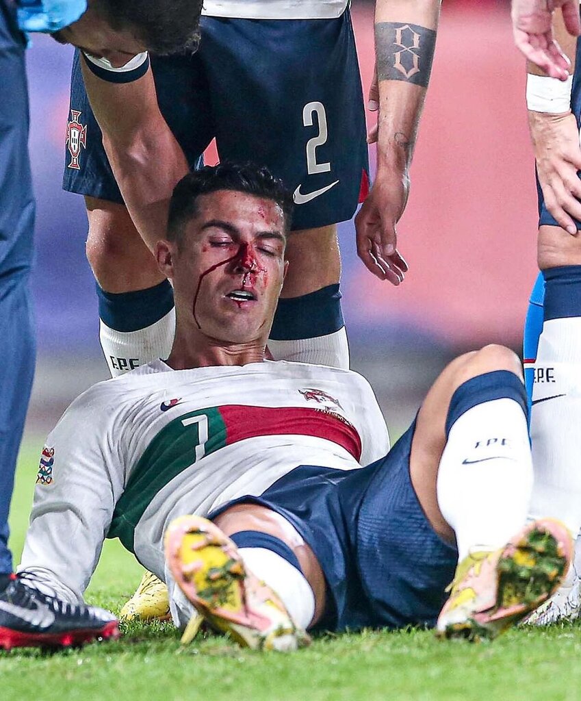 تصاویر | رونالدو و ۴۵ دقیقه نحس! | کریس خونین و مالین شد