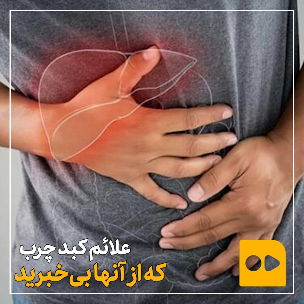 علائم کبد چرب که از آن بی‌خبرید