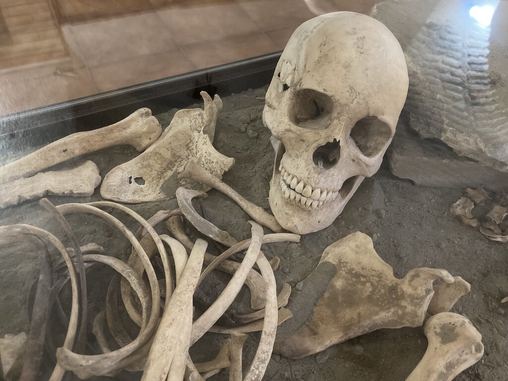 تصاویر |۴۰جمجمه ۵ هزار ساله در نخستین موزه علوم پزشکی | از جسد پیرزن مومیایی شده تا جمجمه پادشاه بهبهان