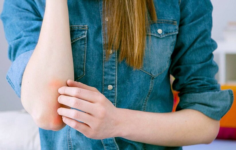 این تغییرات پوستی خبر از کبد چرب میدهد | چگونه میتوان شانس ابتلا به این بیماری پوستی را کاهش داد؟