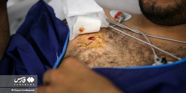 ۴ روایت از زبان پلیسهای مجروحشده در حوادث اخیر | از شلیک تیر خلاص راننده مگان تا قطع عضو با نارنجک