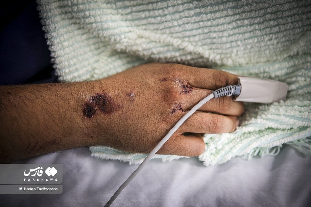 عکس ا مجروحین یگان ویژه پلیس فراجا؛ علت بستری اصابت تیر و برخورد نارنجک !