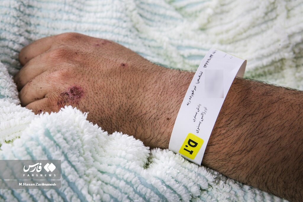 عکس ا مجروحین یگان ویژه پلیس فراجا؛ علت بستری اصابت تیر و برخورد نارنجک !