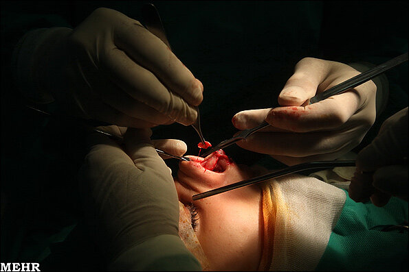 جراحی بینی عمل جراحی جراحی زیبایی