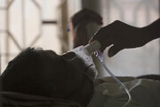سازمان جهانی بهداشت: بیماری سل در جهان برای نخستین بار  پس از سال‌ها در حال افزایش است