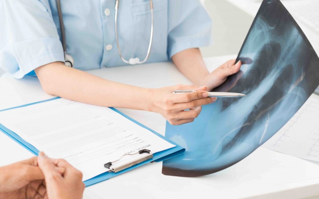 عکس رادیولوژی ریه