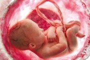 واکنش مهم وزارت بهداشت به خبر ممنوعیت غربالگری جنین | مجوز تولید و واردات کیت‌های غربالگری ۳ ماهه اول بارداری محدود شد؟