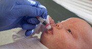 ضرورت اضافه‌شدن واکسن‌های پنوموکوک و روتاویروس به برنامه ایمن‌سازی کودکان
