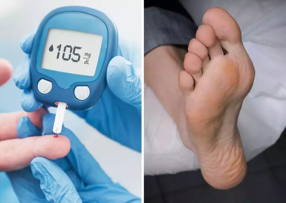 راههای جلوگیری از آسیب چشم ناشی از قند خون