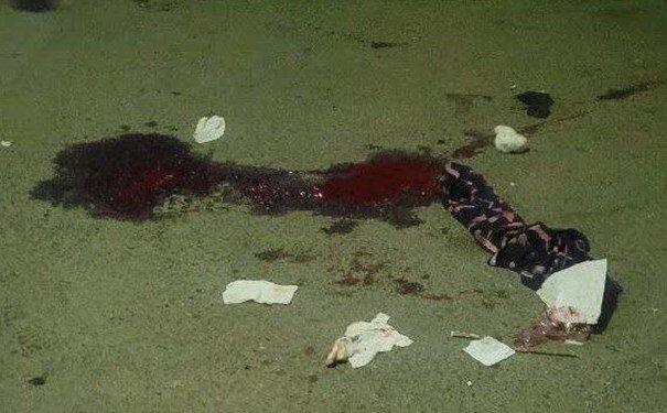 روایت شاهد عینی از ترور پاسدار قاسم فتح اللهی | جزئیات و تصاویر تیراندازی در خیابان مختاری بن بست اول شرقی