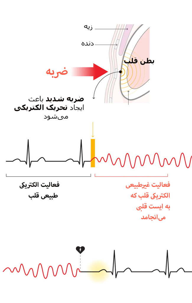 ضربه مرگبار در میدان مسابقه | ایست قلبی پس از ضربه به قفسه سینه چطور رخ میدهد