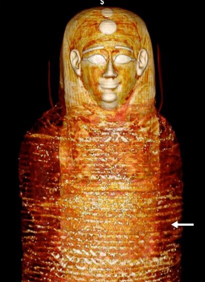 کشف جسد یک پسر با ۴۹ طلسم مختلف | کشف جواهرات در بدن او