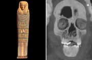 رازهایی که سی‌تی‌اسکن یک مومیایی ۲۳۰۰ ساله فاش کرد | پسر طلایی مصر با ۴۹ طلسم عجیب