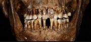 روش عجیب نگه داشتن دندان‌ها توسط این زن ثروتمند قرن هفدهمی! | رنج‌هایی که آن دالگر در زندگی کشید