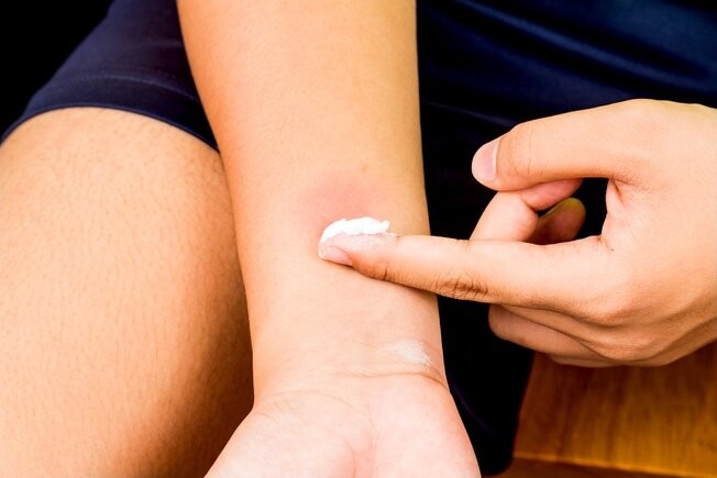 کاربردهای جوش شیرین برای حفظ سلامتی و نظافت بدن | جوش شیرین فقط برای طبخ غذا نیست