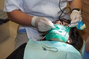 روش‌های درمانی موثر برای پوسیدگی دندان؛ عصب کشی و درمان ریشه دندان