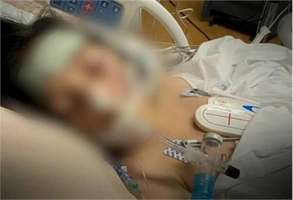 عکس | کودک مجروحشده در حملات تروریستی گروهک جیشالظلم بستری کودک در بیمارستان - مرگ کودک - جسد کودک