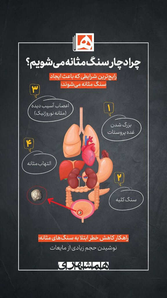چرا دچار سنگ مثانه میشویم ؟ | سادهترین راهکار برای کاهش خطر ابتلا به سنگ مثانه