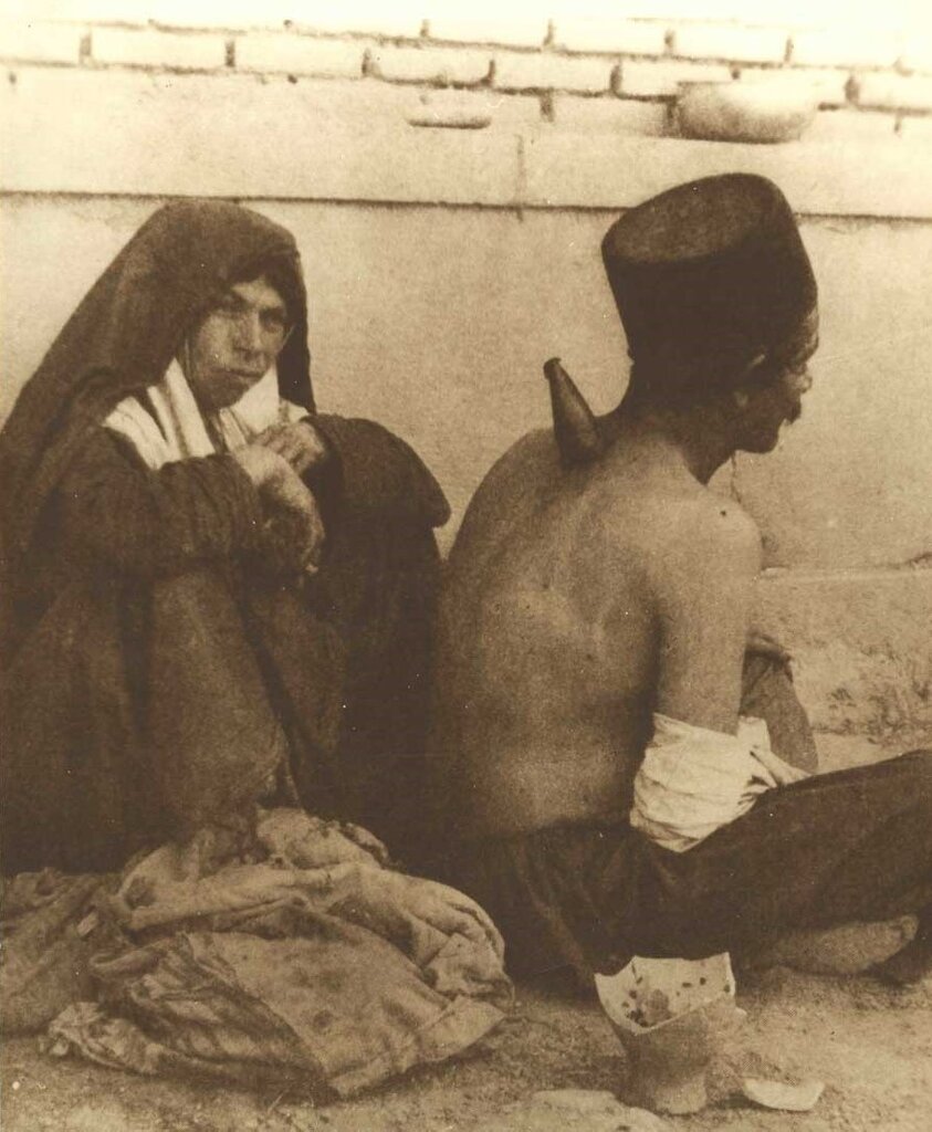 حجامت با شاخ گاو در تهران قدیم!