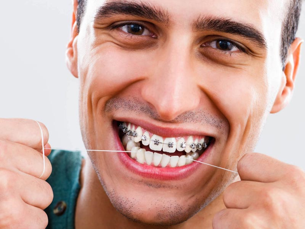 چه کسانی نیاز به ارتودنسی دندان دارند؟
