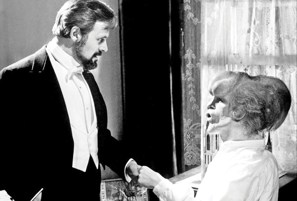 سرگذشت عجیب مردی که فیل نما بود