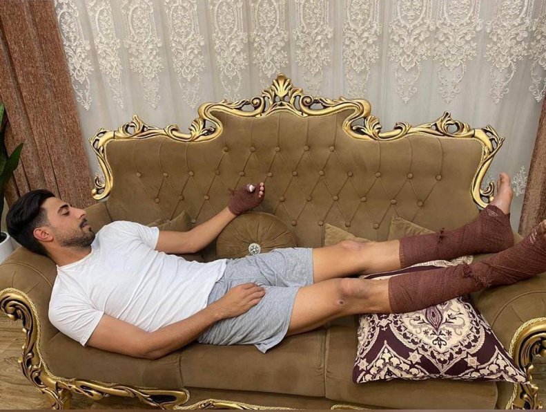 عکس| فوتبالیست ایرانی به دل آتش زد | نجات جان همسایه با سوختن همراه شد