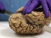 ببینید | تصاویر دلهره‌ آور از مرکز نگهداری مغز در دانمارک | جمع‌ آوری مغز بیماران روانی بدون مجوز خانواده‌ها