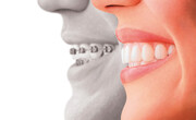 چگونه دندان‌های مرتب داشته باشیم؟