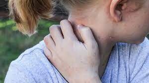 ۷ نشانهی پوستی که خبر از بیماری جدی میدهند