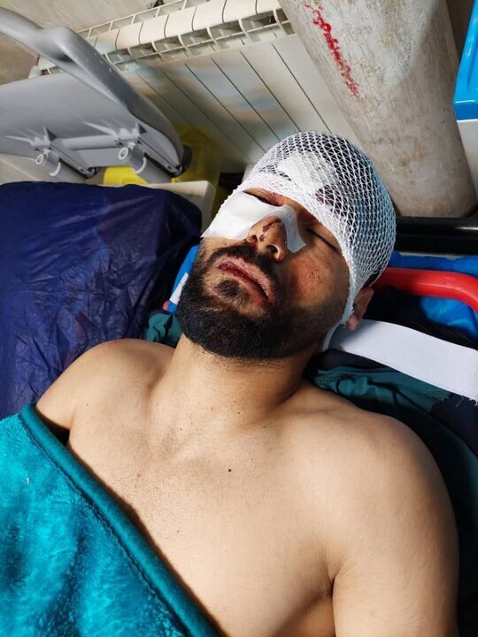 عکس| تصادف شدید ملی پوش فوتبال ایران در راه شمال | آخرین وضعیت بعد از انتقال به تهران