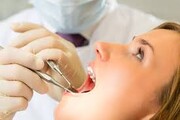 بررسی بیماری‌های مربوط به دهان؛ علل خشکی بیش از انداره دهان چیست