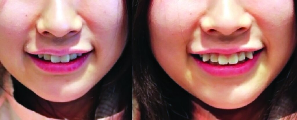 چـــــشم بادامیهای ســردرگـم | عادتها و رسمهای عجیب ژاپنی