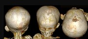 تصاویر | کشف علت مرگ کودکان در مصر باستان | رازهایی که سی تی اسکن مومیایی‌های کودکان فاش کرد
