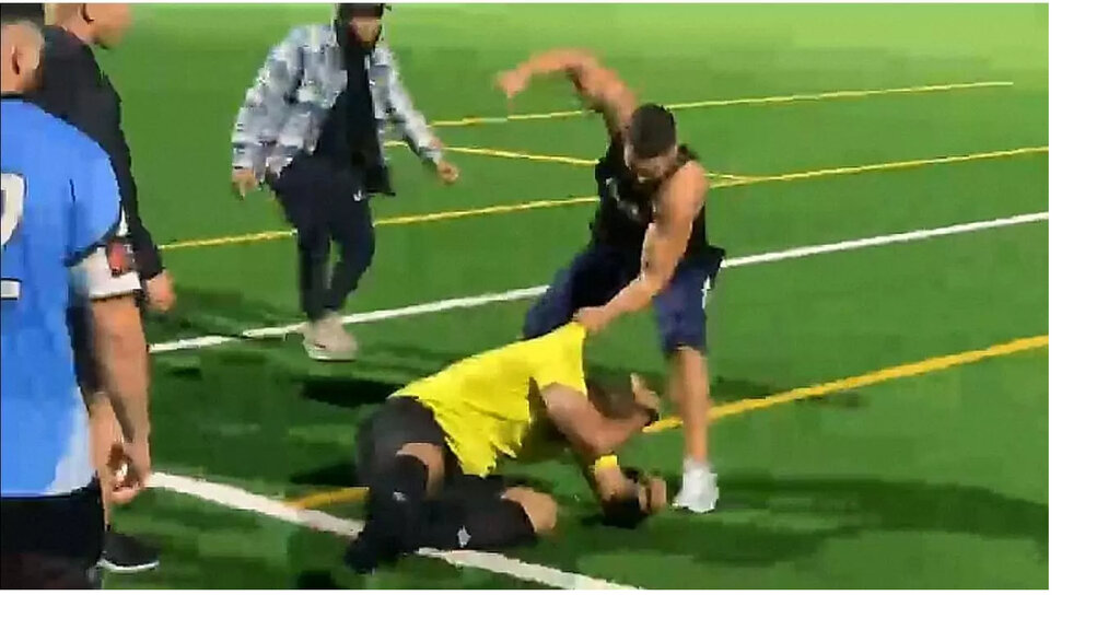 تصاویر | فک و دندان‌های خرد شده داور زیر مشت‌ فوتبالیست بوکسور! | ضربات دیوانه‌وار بازیکن خشمگین به قصد کشت!
