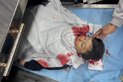 (۱۶+) تصاویر دردناک علی عزالدین کودک فرمانده جهاد اسلامی که در نوار غزه به شهادت رسید