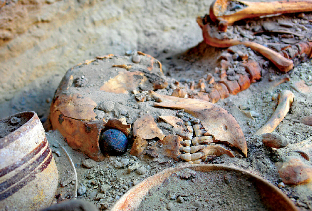 ایرانیان ۵ هزار سال قبل جراحی جمجمه داشتند و چشم مصنوعی ساختند | رازهای حیرت‌انگیز شهر سوخته ؛ کشف تدفین‌های عاشقانه در این شهر!