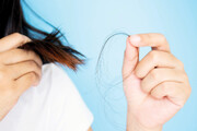 عوامل مهم ریزش موی سر در زنان | روبالشی ابریشمی از ریزش مو جلوگیری می‌کند؟