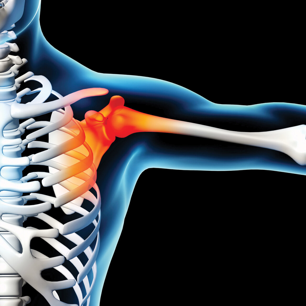اگر دردی در شانه و گردن احساس کردید آن را جدی بگیرید
