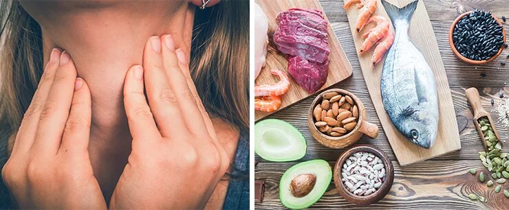 افراد مبتلا به کم کاری تیروئید چه رژیم غذایی باید داشته باشند؟ | آیا مشکلات تیروئید با نوع تغذیه در ارتباط است؟