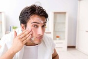 تکنیک‌هایی برای از بین بردن جوش‌ صورت در کوتاه‌ترین زمان ممکن | شایع‌ترین علت‌های آکنه چیست؟