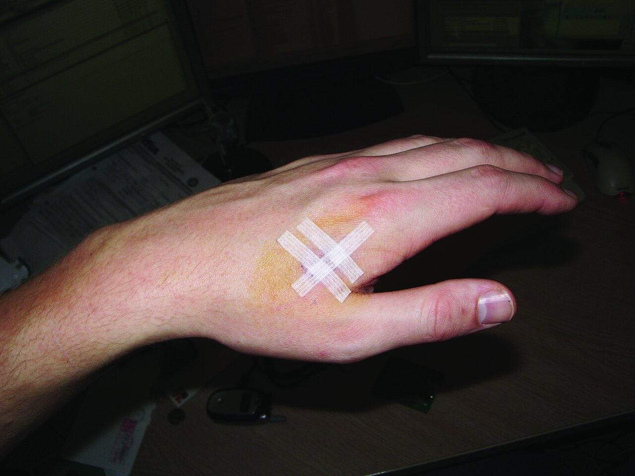 اولین کسی که تراشهها تشخیص هویت را زیر پوست خود گذاشت که بود؟