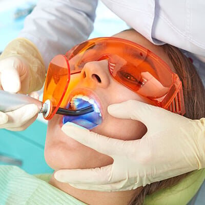 نوع کامپوزیت چه نقشی در زیبایی لبخند شما دارد؟ | عوامل مؤثر در داشتن دندانهای درخشان