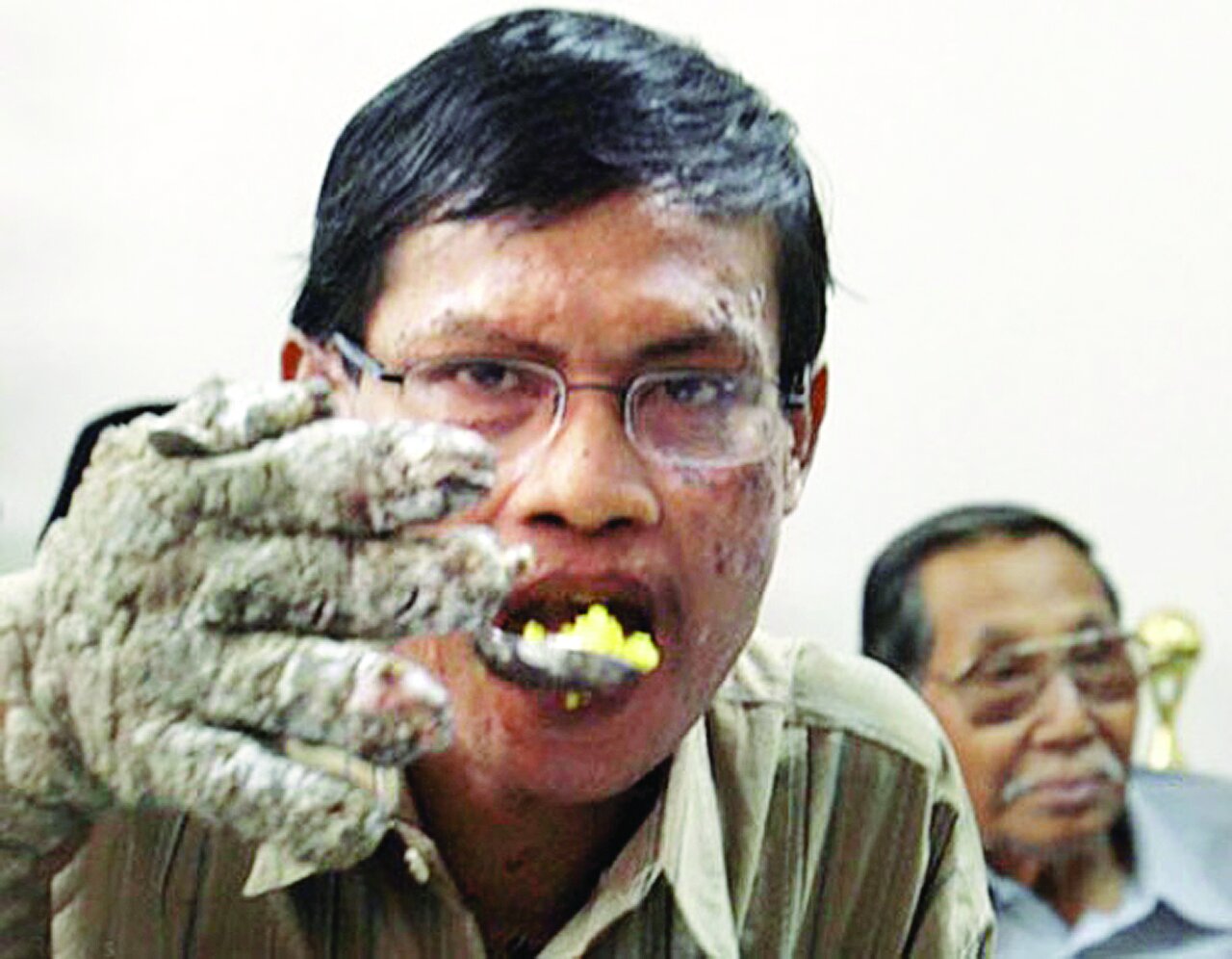 این درخت حرف میزند | تصاویر باور نکردنی از مردی که شبیه درخت شد | او نصفش انسان و نصف دیگرش درخت بود