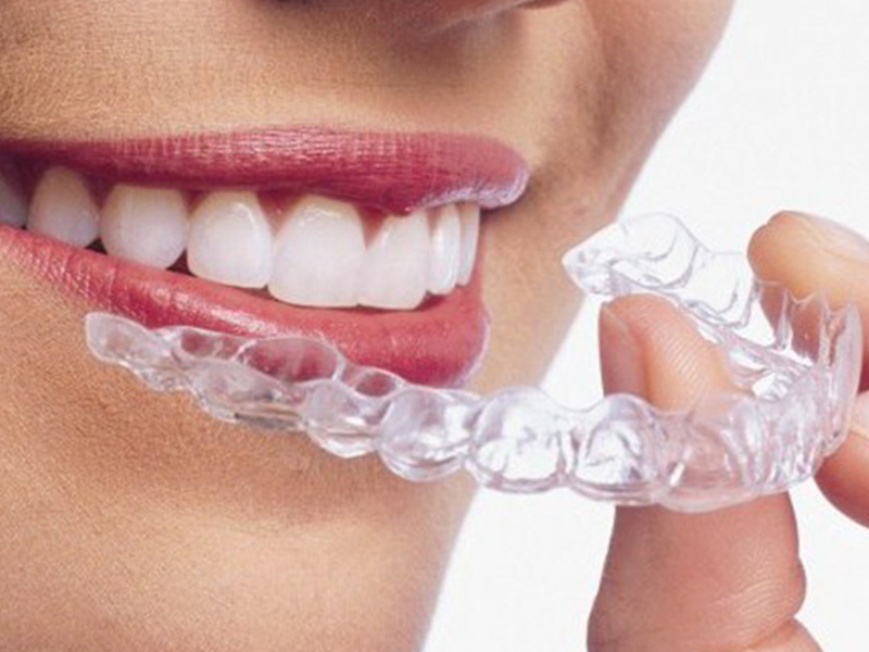 متخصص ارتودنسی چه فرقی با دندانپزشک دارد؟