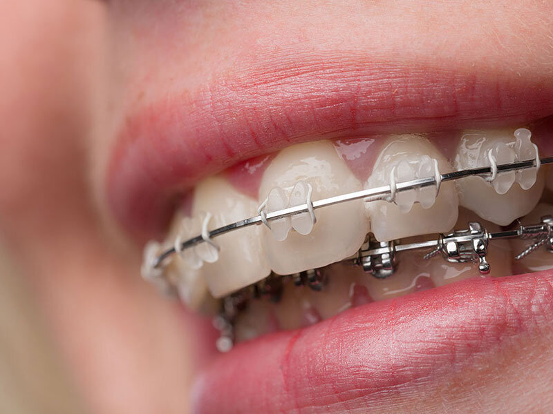 متخصص ارتودنسی چه فرقی با دندانپزشک دارد؟